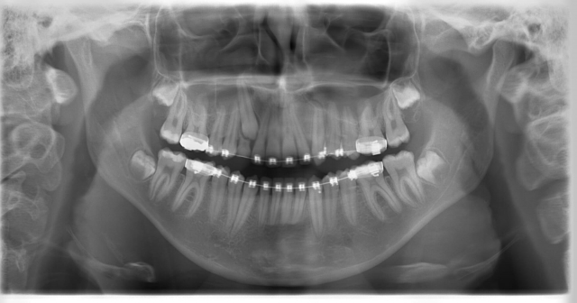 Morita 2dcp Ortodonti Röntgen