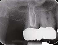 Dental Radyoloji Cihazı Görüntüsü