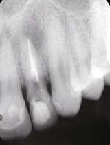 Dental Radyoloji Cihazları - Tomografi