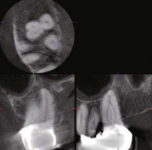 Dental Radyoloji Cihazları - 3D Görüntü
