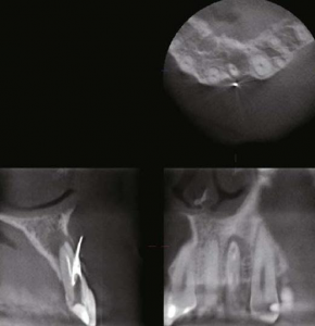 Dental Radyoloji Cihazı - 3D Tomografi