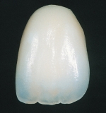 Porselen Diş