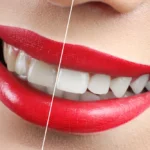 Dental Fotoğrafçılık Neden Gerekli