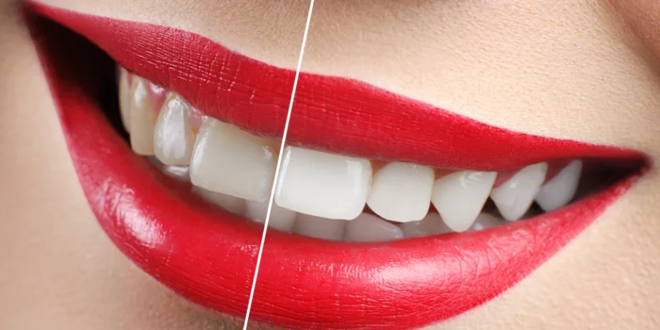 Dental Fotoğrafçılık Neden Gerekli