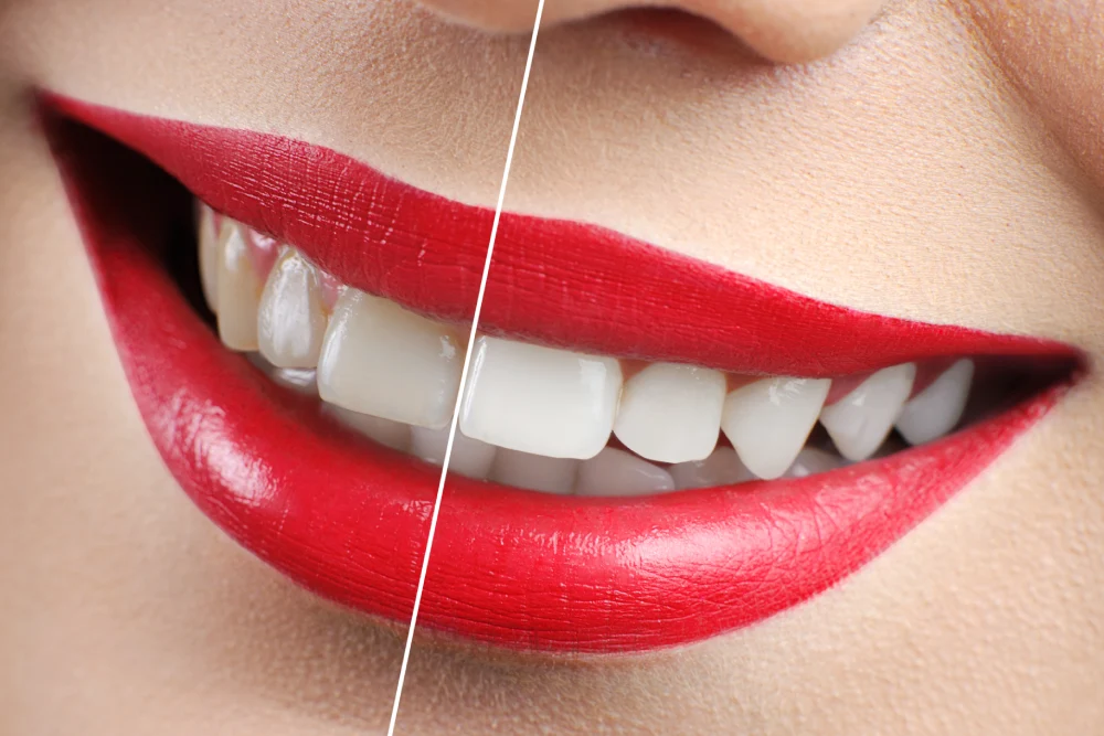Dental Fotoğrafçılık Neden Gerekli