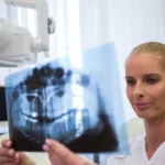 endodonti tedavilerinde periapikal röntgen cihazı rolü