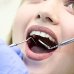 Periodontoloji Tedavisi Nedir, Nasıl Yapılır ve Ne Kadar Sürer